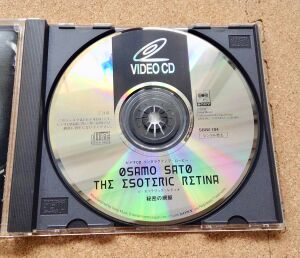 EsotericRetinaDisc.jpg